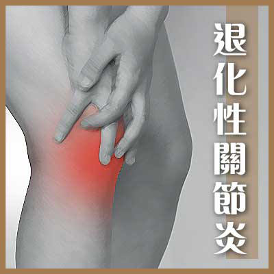 退化性關節炎